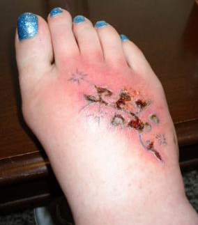 white spots and tattoo infection  Tatto Gambar